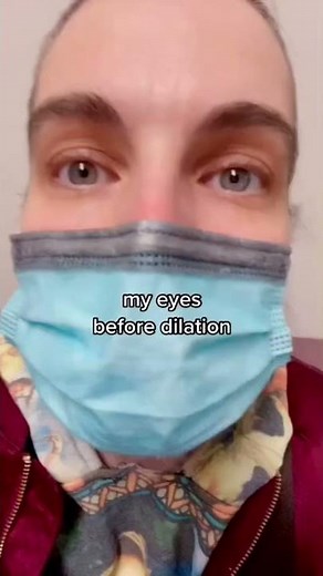 Dilated pupils: My eyes before and after dilation!
