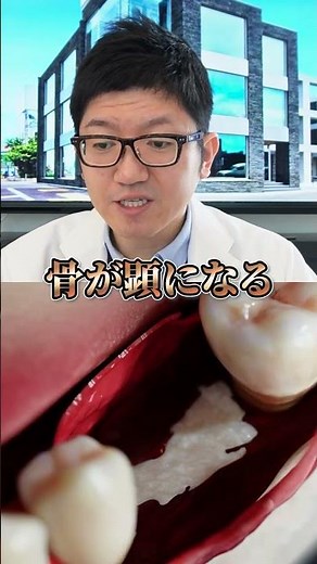 How Does Dental Implant Simulation Work? Explained by a Dentist! 【Yoshioka Dental Clinic】