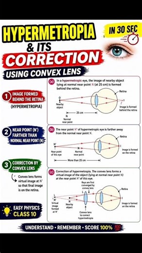 Hypermetropia Explained 👁️ | Defect of Vision & Its Correction (Convex Lens) | Class 10 Physics
