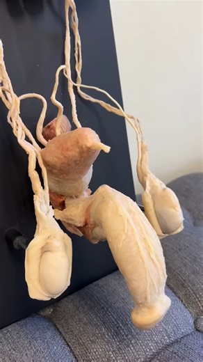 How Medical Works on Instagram: "The art of plastination reveals the remarkable preservation of urogenital anatomy. Deeply humbled by the donor’s gift - two intense days of dissection showing just how beautifully intricate the human body truly is. 🤍 Video Credit: @experienceanatomy #educational #explore #viral #reels #medical"