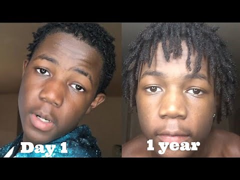 Dreadlocks Transformation Day 1 to 1 Year