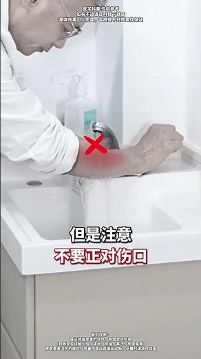 Top 5 Must-Know Burn First Aid Tricks for Quick Relief