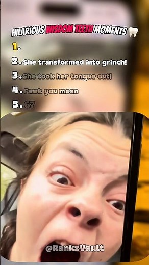 Hilarious Wisdom Teeth Moments#wisdomteeth #compilation