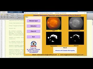 Diabetic Retinopathy Detection using Convolutional Neural Network full Matlab Project