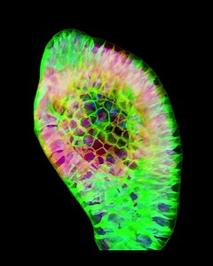 34 reactions | In this new episode of our case study series "From Image to Results", explore an imaging experiment performed on intestinal organoids treated with and without a Wnt-inhibiting drug. What is the role of Wnt signaling in organoid formation? Read it here  https://zeiss.ly/fb-fitr-organoids #organoid #intestinal #organoids #cellbiology #imaging #microscopy #FromImagetoResults | ZEISS Microscopy | Facebook