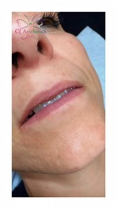  Stop scrolling — this is how I do lips that make you look twice ...