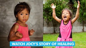 50K views · 1.6K reactions | Jocy's story of healing is just one of thousands from the Tebow CURE Hospital and we want YOU to be a part of the next story of transformation! Learn more about how the Tim Tebow Foundation brings Faith, Hope & Love to children around the world and join a Kingdom minded organization focused on fighting for those who can't fight for themselves. 100% of your gift goes straight toward serving children & sharing God's love! | Tim Tebow Foundation | Facebook
