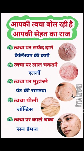 Skin Signs That Reveal Hidden Diseases चेहरे के दाग = अंदर की बीमारी? 😳 #easynutrition #healthydiet