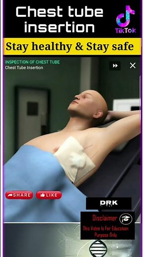 Chest Tube Placement Thoracostomy Procedure