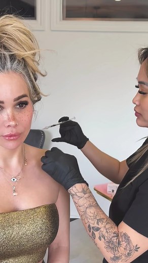 TRAP TOX aka Barbie Botox Experience the therapeutic benefits of Trap Botox! Our precise injections provide targeted relief for tense muscles in the shoulders and neck. Alleviate discomfort and enhance mobility with this specialized medical treatment. “Trap Tox” benefits include: - Muscle Tension Relief - Migraine and Headache Relief - More delicate appearance of neck and shoulders Rx: 25 Units of Dysport per side were used. Dosing is individually based and dependent on muscle strength Full Resu