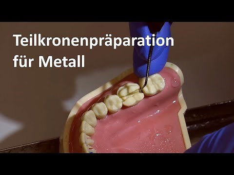 Präparation der Metallteilkrone: Teilkronenpräparationen für Metall [4K]