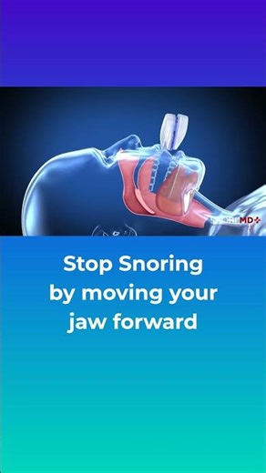 How SnoreMD Stops Snoring Instantly