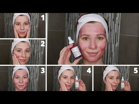How to Apply The Ordinary 30% AHA + 2% BHA Peeling Solution with Niacinamide and Alpha Arbutin