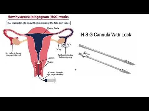 Gynaecological Instruments used in Surgery and Delivery of Baby #childbirth #parturition