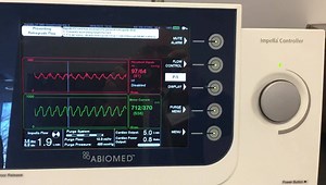 6.5K views · 70 reactions | This is a simulator to train interventional operators how to set up and place an Abiomed Impella percutaneous ventricular assist pump. Abiomed has the simulator in its training facility at its corporate headquarters in Danvers, Massachusetts, just north of Boston. It allows users to implant the catheter-based pump in the pumping heart, which allows for realistic hemodynamic data on the Impella console. | Diagnostic and Interventional Cardiology - DAIC | Facebook