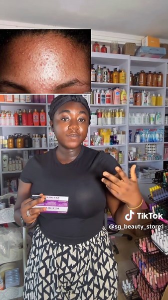 Fungal Acne Treatment and Skincare Essentials