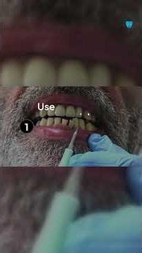 Regular vs. Deep Dental Cleaning: What’s the difference? 🩸🦷