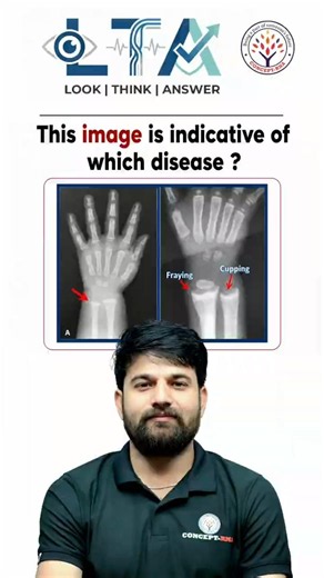 Disease Identification😷| Nursing MCQ Series #nursing #nursingmcq #norcet #esic #rrbnursing #choexam