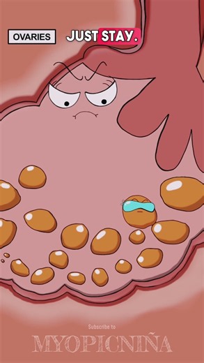 Why Exactly You Miss Your Period?