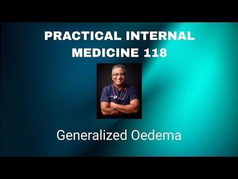 Practical Internal Medicine 118 : Generalized Oedema