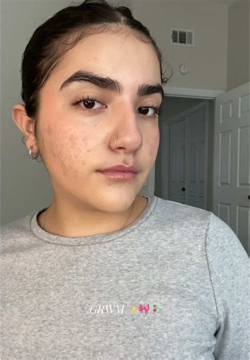 Essential Skincare and Makeup Tips for Acne-Prone Skin