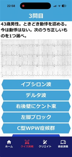 #心電図検定2級問題