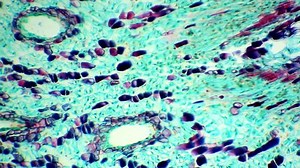 Longitudinal section of female pine cones under a microscope (Pinus Female Strobile L.S.), Full HD