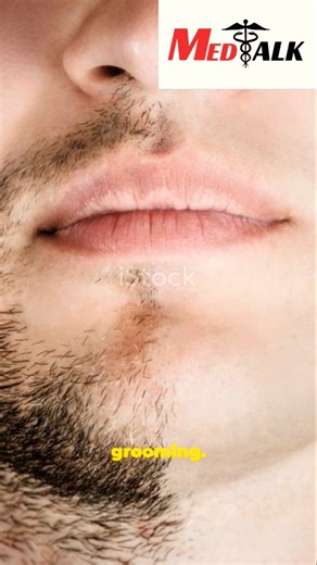 #Hemineglect#Brain#Neuro #Rare#Brain#Health#Medicall#Facts#Viral#Trending#Shorts#FYP#reels#tiktok