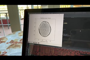 Biomedical Imaging: Brain Tumor Detection