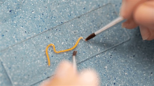 Worry 'Bout It: Live Worm Removed From Woman's Brain