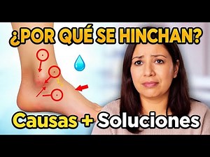 Why do my feet and ankles swell? Causes and solutions