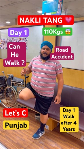 Above Knee Artificial Leg | Geometric Knee | Ossur Leg | Nakli Tang | Prosthetic Knee Cost | #ossur