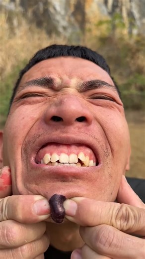 Mole removal tricks ASMR funny short video 🤣 #funny #shorts #trending