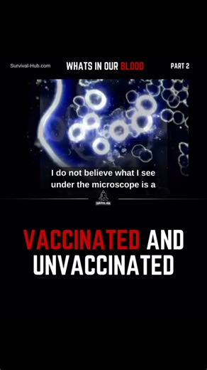 Survival Hub on Instagram: "What’s showing up in blood isn’t random. And it isn’t “just inflammation.” What’s being observed—again and again—are structures. Self-assembling. Synthetic. Coordinated. Responsive to frequency. Persistent across populations. This isn’t pathology in the old sense. It’s architecture. Whatever entered the body didn’t come alone—and it didn’t leave on its own. That’s why people feel off but never “sick enough.” Why symptoms don’t match clean diagnoses. Why damage shows u