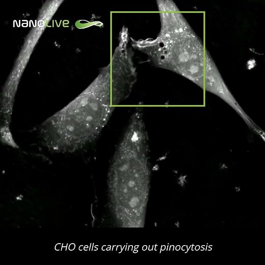 Label free live cell imaging of macropinocytosis