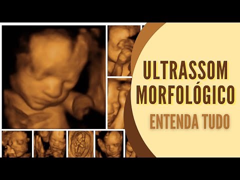 MORPHOLOGICAL ULTRASOUND: What is it? When to do it? How is done? Where to do it? Understand Ev...