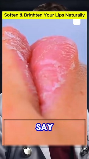 Say goodbye to dull lips! Discover this powerful secret recipe to get pink and soft lips naturally. | Your Healthy | Facebook