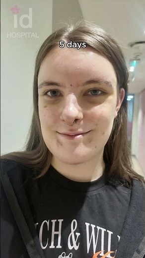 What FFS Did to Jamie's Face in 5 Months?