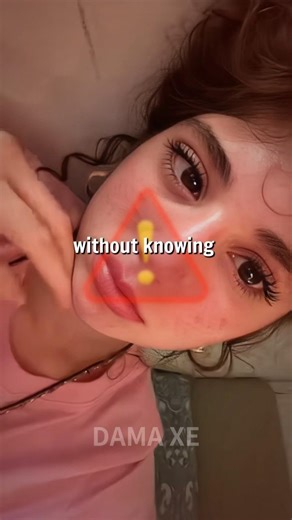 💁‍♀️Most People Treat Acne Wrong ❌Acne Face Mapping