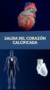 🚨Válvula del corazón calcificada🫀 Estenosis aortica