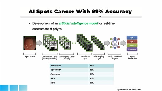 How can AI revolutionize polyp detection during endoscopy? This video explores an AI model designed for real-time polyp diagnosis. Key points: • Accuracy and efficiency in identifying polyps. • Continuous development to enhance sensitivity and specificity. • Potential to improve diagnostic outcomes. Watch the full lecture and explore our complete course library at EndoCollab.com. #gastroenterology #gastroenterologia #endoscopy #endoscopia #polypdetection | EndoCollab