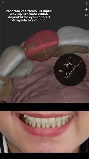 #smilecloud #smiledesign #3dna #dentistry