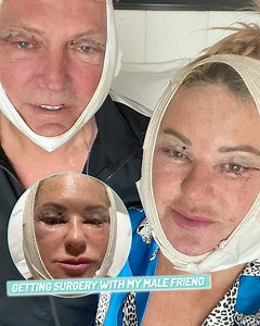 24K views · 255 reactions | We both went to Turkey to get the same plastic surgery done - we want to look 20 years younger 爛 | Ultimate | Facebook