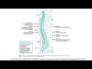 Pregnancy and spinal cord injury- TOG article revision for MRCOG part 2 💉🩺📚