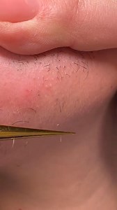 Quitándome los vellos en la barbilla para que el amor de mi no sienta envida 🥲 PS. Escucha todo el video antes de comentar 🫶🏻 y usa las Chazón para una depilada perfecta! #facialhairremoval #forwomen #pinzaschazon #chazontweezers #storytime #asmr #depilacionconpinzas #videodelapinza #barbillaparte2 #danielavellos | Hermosas sin o con vellos