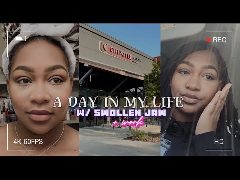 a day in my life w/ a swollen jaw + work day ♡♡