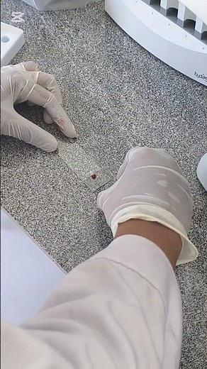 The Correct Way to Prepare a Blood Film | Lab Skills | Haematology