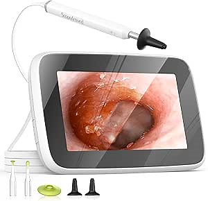 ScopeAround Digital Otoscope with Light, Ear Cleaning Camera and Wax Remover, Visual Ear Cleaner with 4.3" IPS Screen, 6 LED Lights, HD Video Ear Scope Camera, Supports Photo Snap and Video Recording