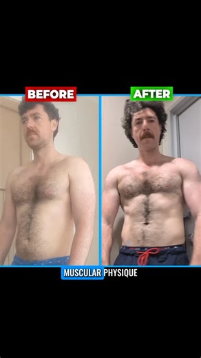 Pectus Excavatum Specialised Trainer on Instagram: "Rounded posture & extra body fat make the sunken chest and pectus potbelly look so much worse ❌ Improving posture & developing a lean muscular physique enabled George to make his pectus look hardly noticeable in less than a year 💪🏼"