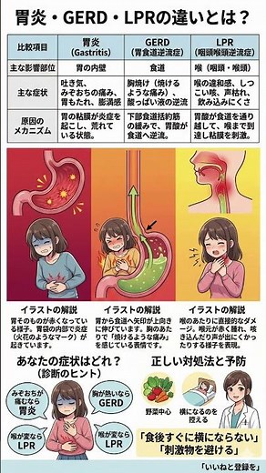 【胃・胸・喉】その違和感はどれ？胃炎・GERD・LPRの違いを徹底解説！放置すると怖い逆流トラブルの見分け方